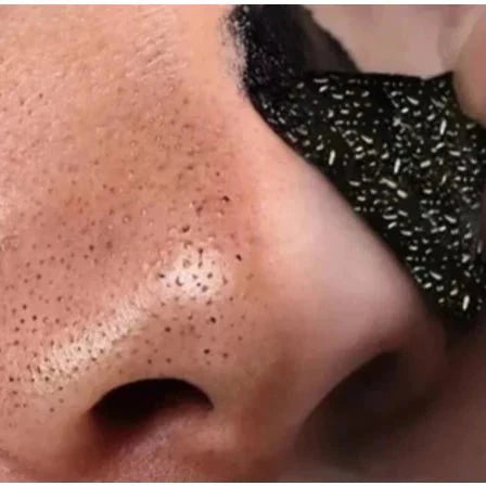 Blackhead Remover Strips with Activated Charcoal - Kit of 10 Units